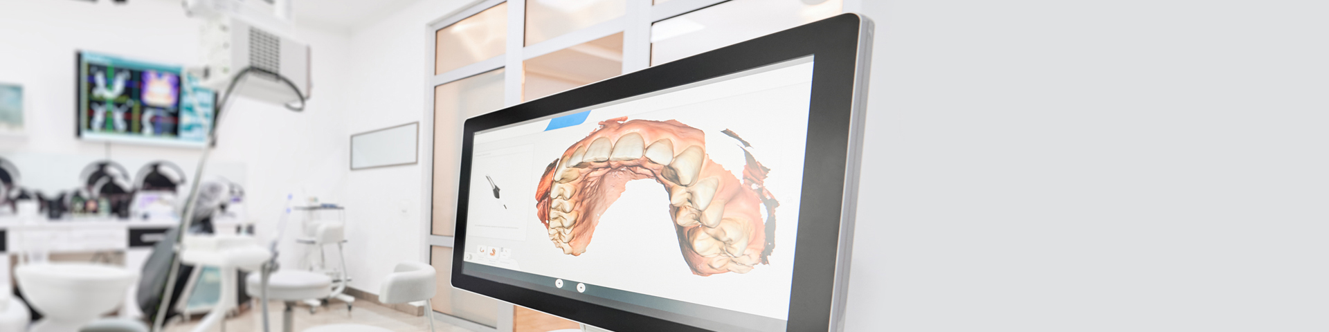 Oral Cancer Screenings