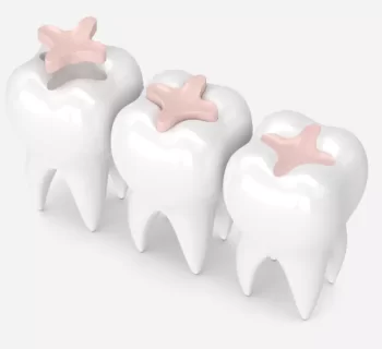 How Dental Fillings Can Help Improve Oral Health in People with Diabetes in Tempe