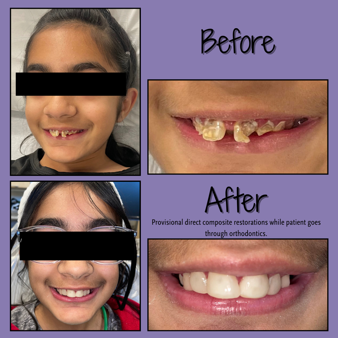 Orthodontics Before After